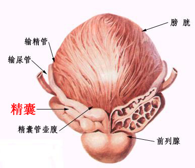 慢性精囊炎