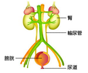 输尿管结石